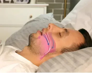 image of man sleeping with a draw diagram of the airway