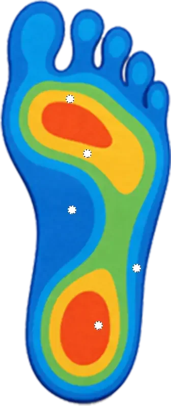 Foot Support Zones